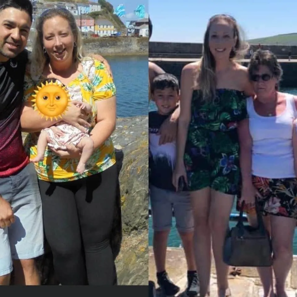 Weight loss surgery before and after transformation - patient 12