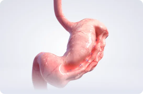 Modern endoscopic suite prepared for a minimally invasive weight loss procedure